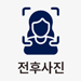 전후사진