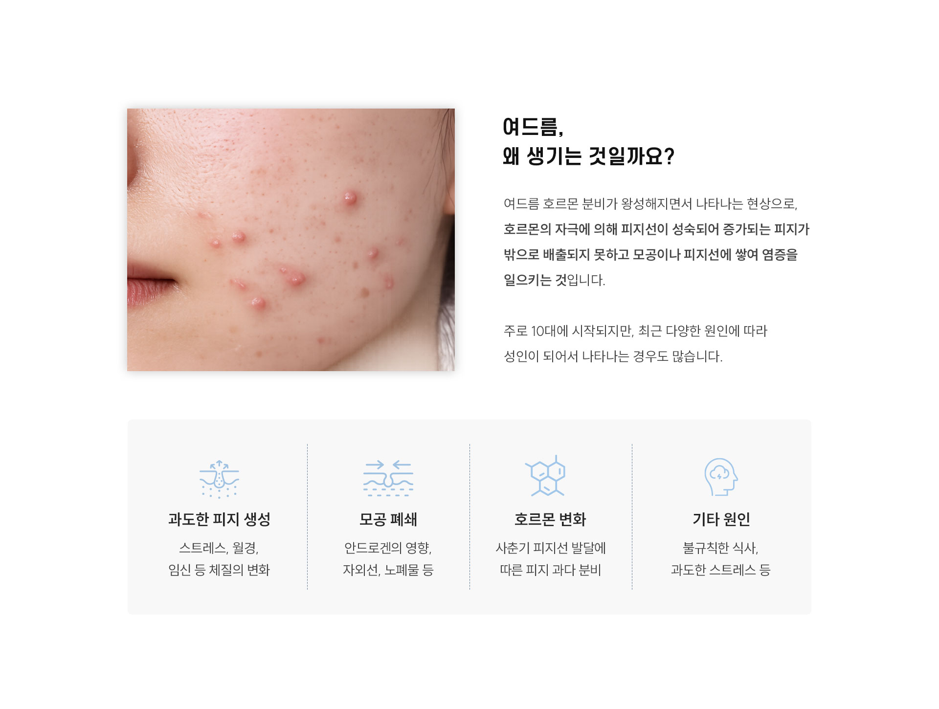 
	Q. 여드름은 왜 생기는 것일까요?
	A. 여드름은 호르몬 분비가 왕성해지면서 나타나는 현상으로, 호르몬의 자극에 의해 피지선이 성숙되어 증가되는 피지가 밖으로 배출되지 못하고 모공이나 피지선에 쌓여 염증을 일으키는 것입니다.
	주로 10대에 시작되지만, 최근 다양한 원인에 따라 성인이 되어서 나타나는 경우도 많습니다.
	- 과도한 피지 생성
	•	스트레스, 월경, 임신 등 체질의 변화
	- 모공 폐쇄
	•	안드로겐의 영향, 자외선, 노폐물 등
	- 호르몬 변화
	•	사춘기 피지선 발달에 따른 피지 과다 분비
	- 기타 원인
	•	불규칙한 식사, 과도한 스트레스 등
	