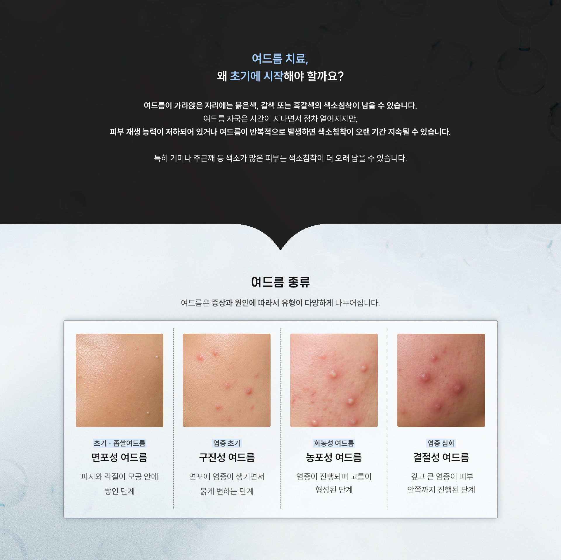 
	Q. 여드름 치료는 왜 초기에 시작해야 할까요?
	A. 여드름이 가라앉은 자리에는 붉은색, 갈색 또는 흑갈색의 색소침착이 남을 수 있습니다.
	여드름 자국은 시간이 지나면서 점차 옅어지지만,
	피부 재생 능력이 저하되어 있거나 여드름이 반복적으로 발생하면 색소침착이 오랜 기간 지속될 수 있습니다.
	특히 기미나 주근깨 등 색소가 많은 피부는 색소침착이 더 오래 남을 수 있습니다.

	Q. 여드름은 어떤 종류가 있나요?
	A. 여드름은 증상과 원인에 따라서 유형이 다양하게 나누어집니다.
	- 면포성 여드름 (초기 · 좁쌀여드름)
	•	피지와 각질이 모공 안에 쌓인 단계
	- 구진성 여드름 (염증 초기)
	•	면포에 염증이 생기면서 붉게 변하는 단계
	- 농포성 여드름 (화농성 여드름)
	•	염증이 진행되며 고름이 형성된 단계
	- 결절성 여드름 (염증 심화)
	•	깊고 큰 염증이 피부 안쪽까지 진행된 단계
	