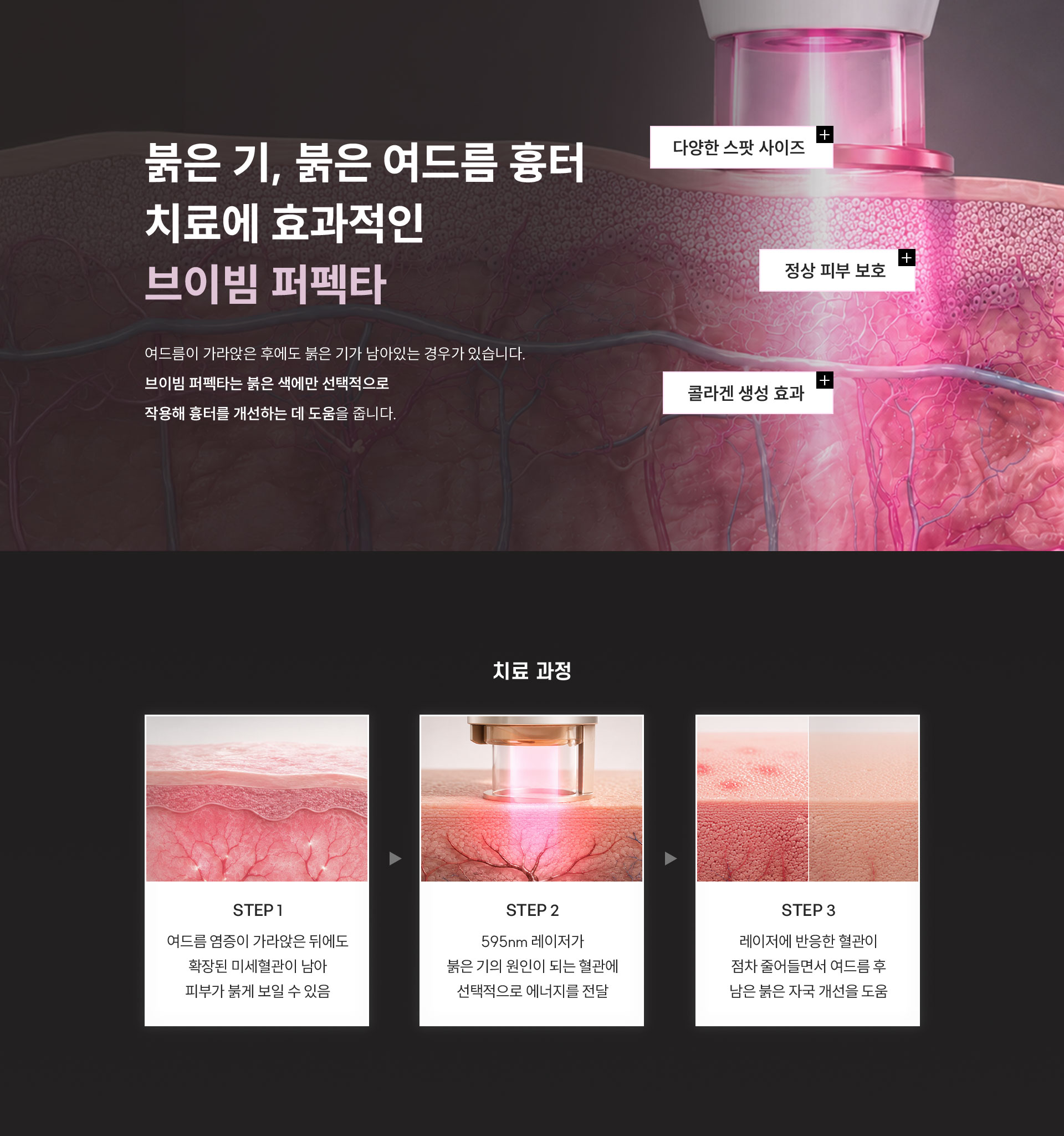 
	10.	붉은기, 붉은 여드름 흉터 치료에 브이빔 퍼펙타가 효과적인 이유는?
	여드름이 가라앉은 후에도 붉은기가 남아있는 경우가 있습니다. 
	브이빔 퍼펙타는 붉은 색에만 선택적으로 작용해 흉터를 개선하는 데 도움을 줍니다.
	+ 다양한 스팟 사이즈, + 정상 피부 보호, + 콜라겐 생성 효과

	치료 과정
	STEP1 - 여드름 염증이 가라앉은 뒤에도 확장된 미세혈관이 남아 피부가 붉게 보일 수 있음
	STEP2 - 595nm 레이저가 붉은기의 원인이 되는 혈관에 선택적으로 에너지를 전달
	STEP3 - 레이저에 반응한 혈관이 점차 줄어들면서 여드름 후 남은 붉은 자국 개선을 도움
	