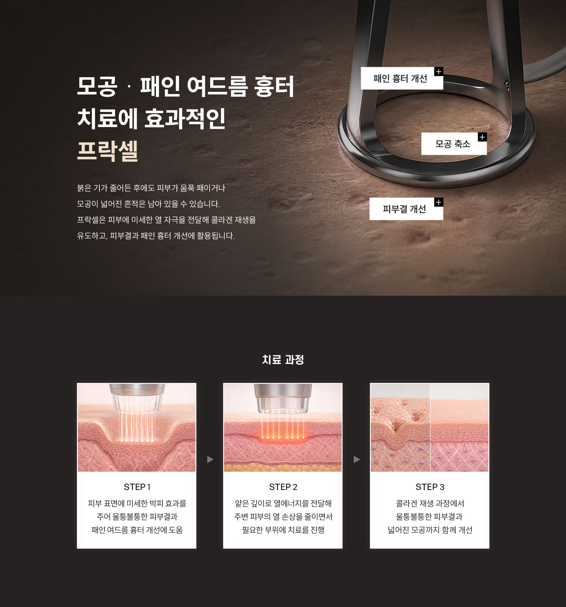 
	11.	모공 · 패인 여드름 흉터 치료에 프락셀이 효과적인 이유는?
	붉은 기가 줄어든 후에도 피부가 움푹 패이거나 모공이 넓어진 흔적은 남아 있을 수 있습니다. 
	프락셀은 피부에 미세한 열 자극을 전달해 콜라겐 재생을 유도하고, 피부결과 패인 흉터 개선에 활용됩니다.
	+ 패인 흉터 개선, + 모공 축소, + 피부결 개선

	치료 과정
	STEP1 - 피부 표면에 미세한 박피 효과를 주어 울퉁불퉁한 피부결과 패인 여드름 흉터 개선에 도움
	STEP2 - 얕은 깊이로 열에너지를 전달해 주변 피부의 열 손상을 줄이면서 필요한 부위에 치료를 진행
	STEP3 - 콜라겐 재생 과정에서 울퉁불퉁한 피부결과  넓어진 모공까지 함께 개선
	