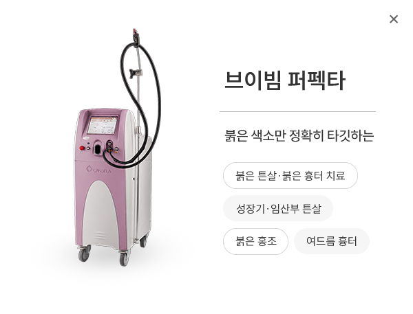 브이빔 퍼펙타