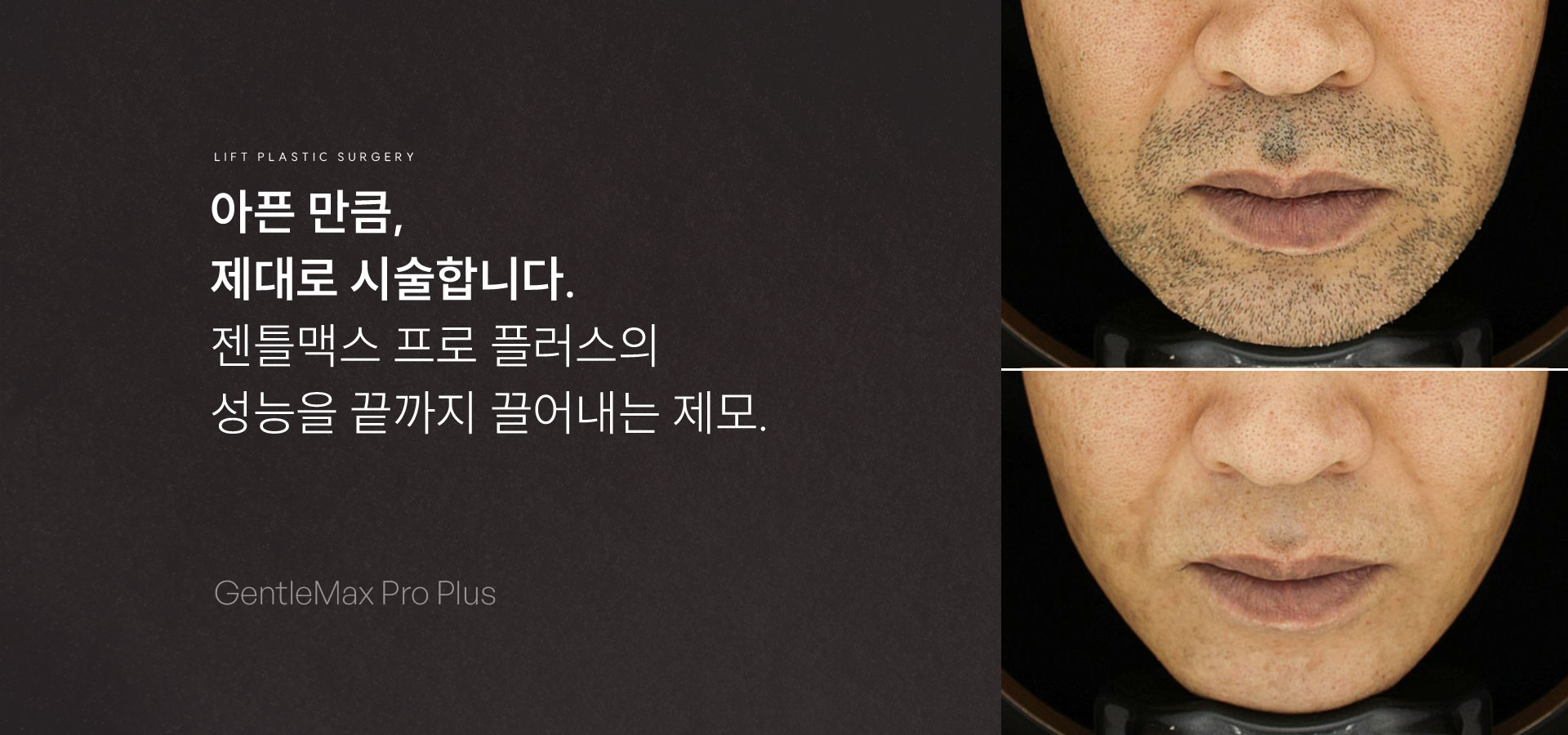 
	“대구에서 가장 오래, 가장 많이. 레이저 시술의 기준이 다릅니다.”
	