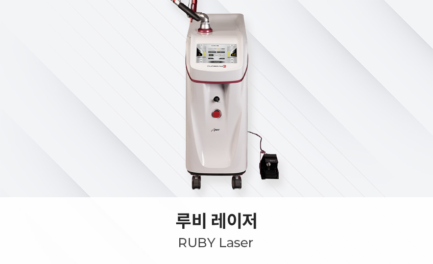루비 레이저