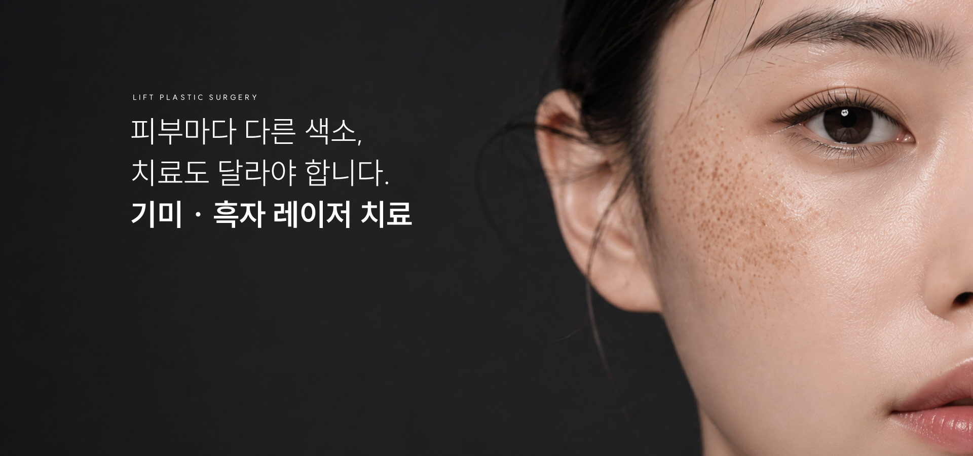 
	피부마다 다른 색소, 치료도 달라야 합니다. 기미 · 흑자 레이저 치료
	