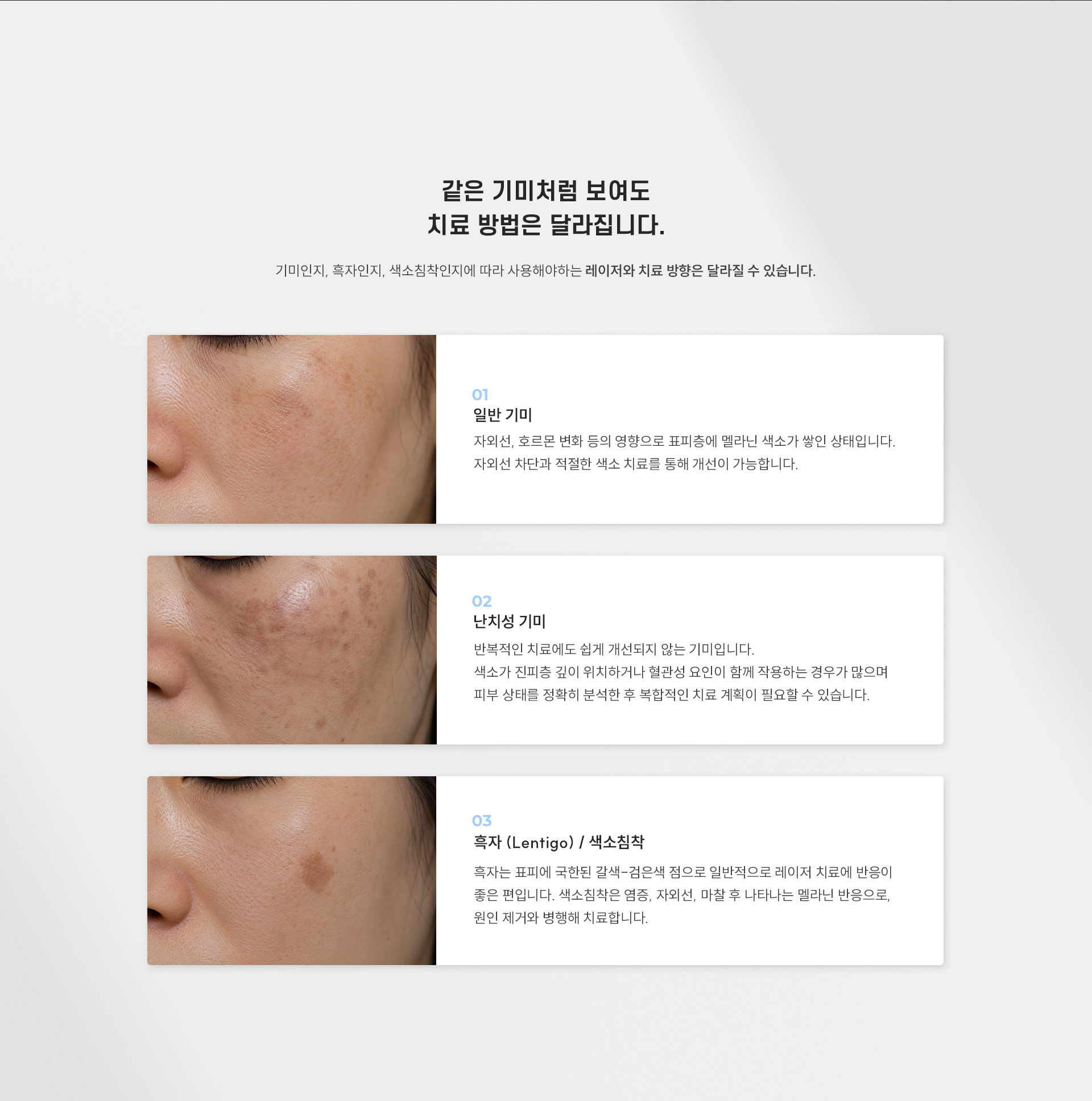 
	2.	같은 기미처럼 보여도 치료 방법은 왜 달라질까요?
	기미인지, 흑자인지, 색소침착인지에 따라 사용해야 하는 레이저와 치료 방향은 달라질 수 있습니다.
	1)	일반 기미
	- 자외선, 호르몬 변화 등의 영향으로 표피층에 멜라닌 색소가 쌓인 상태입니다.
	자외선 차단과 적절한 색소 치료를 통해 개선이 가능합니다.
	2)	난치성 기미
	- 반복적인 치료에도 쉽게 개선되지 않는 기미입니다.
	색소가 진피층 깊이 위치하거나 혈관성 요인이 함께 작용하는 경우가 많으며, 피부 상태를 정확히 분석한 후 복합적인 치료 계획이 필요할 수 있습니다.
	3)	흑자(Lentigo) / 색소침착
	- 흑자는 표피에 국한된 갈색-검은색 점으로 일반적으로 레이저 치료에 반응이 좋은 편입니다.
	색소침착은 염증, 자외선, 마찰 후 나타나는 멜라닌 반응으로, 원인 제거와 병행해 치료합니다.
	