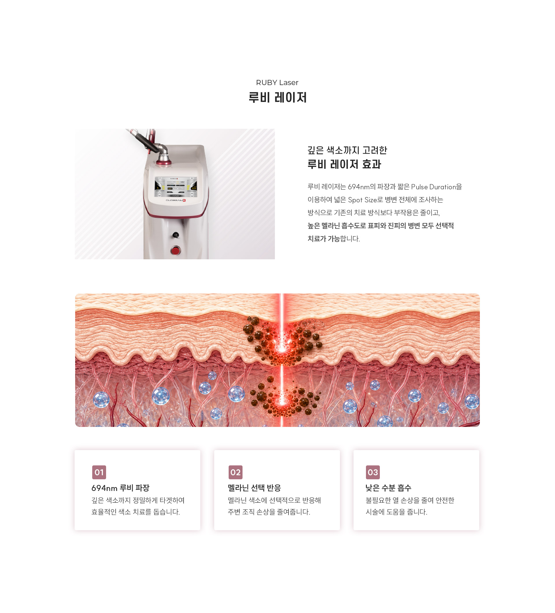 
		8.	깊은 색소까지 고려한 루비 대구레이저란?
		루비 레이저는 694nm의 파장과 짧은 Pulse Duration을 이용하여 넓은 Spot Size로 병변 전체에 조사하는 방식으로 기존의 치료 방식보다 부작용은 줄이고, 높은 멜라닌 흡수도로 표피와 진피의 병변 모두 선택적 치료가 가능합니다.
		1)	694nm 루비 파장
		- 깊은 색소까지 정밀하게 타겟하여 효율적인 색소 치료를 돕습니다.
		2)	멜라닌 선택 반응
		- 멜라닌 색소에 선택적으로 반응해 주변 조직 손상을 줄여줍니다.
		3)	낮은 수분 흡수
		- 불필요한 열 손상을 줄여 안전한 시술에 도움을 줍니다.
		