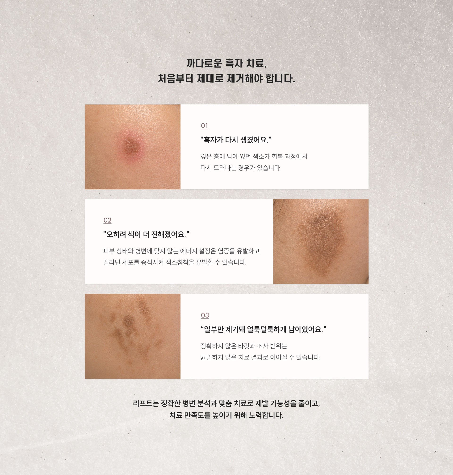 
	14.	까다로운 흑자 치료, 처음부터 제대로 제거해야 하는 이유는 무엇일까요?
	1) 흑자가 다시 생겼어요.
	•	깊은 층에 남아 있던 색소가 회복 과정에서 다시 드러나는 경우가 있습니다.
	2) 오히려 색이 더 진해졌어요.
	•	피부 상태와 병변에 맞지 않는 에너지 설정은 염증을 유발하고 멜라닌 세포를 증식시켜 색소침착을 유발할 수 있습니다.
	3) “일부만 제거돼 얼룩덜룩하게 남아있어요.
	•	정확하지 않은 타깃과 조사 범위는 균일하지 않은 치료 결과로 이어질 수 있습니다.

	리프트는 정확한 병변 분석과 맞춤 치료로 재발 가능성을 줄이고, 치료 만족도를 높이기 위해 노력합니다.
	