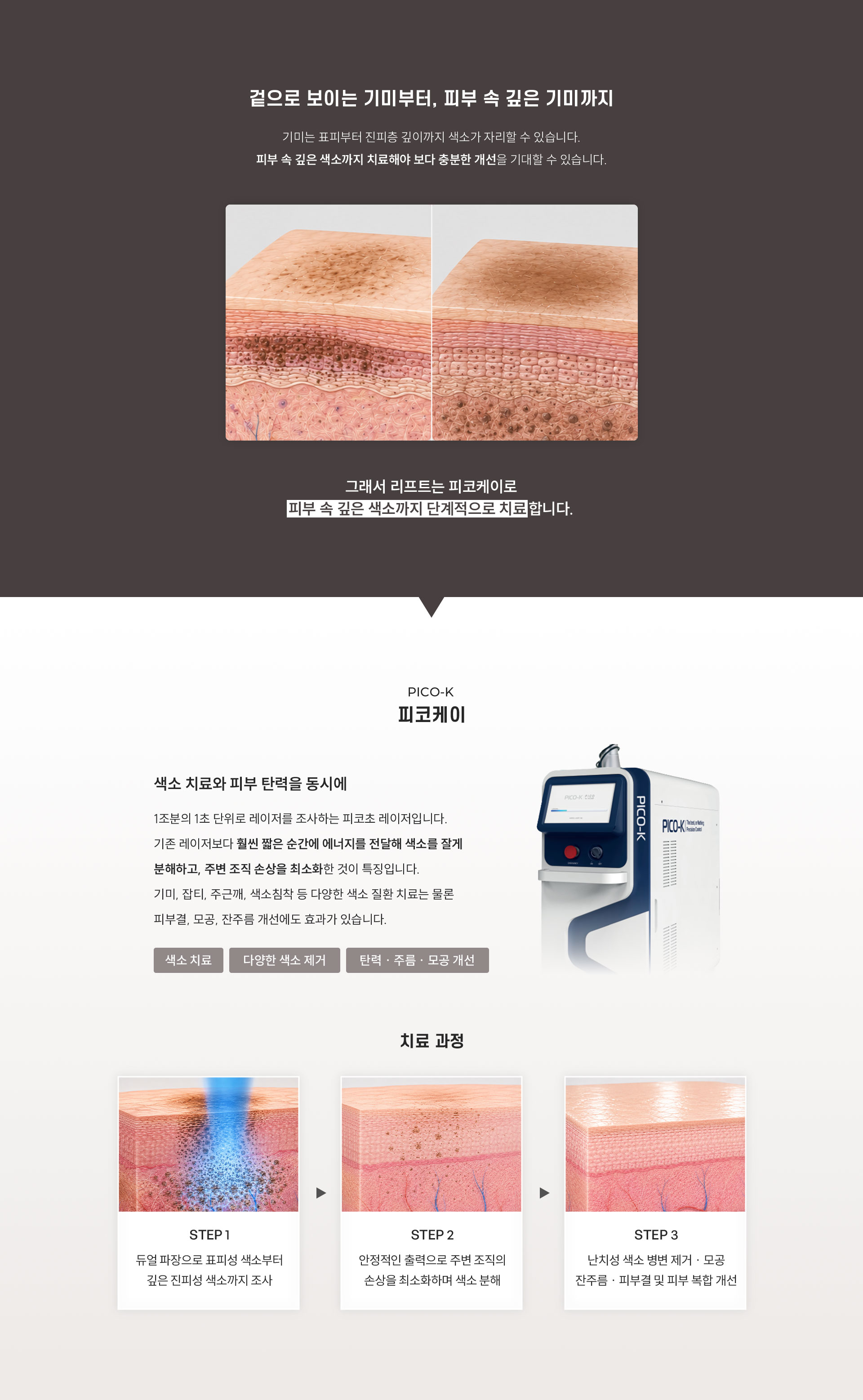 
	Q. 피코케이는 어떤 레이저인가요?
	A.정밀함과 안정성, 모두 잡은 피코케이 레이저
	피코케이는 1조분의 1초 단위로 레이저를 조사하는 피코초 레이저입니다.
	기존 레이저보다 훨씬 짧은 순간에 에너지를 전달해 색소를 잘게 분해하고, 주변 조직 손상을 최소화 하면서 부담을 줄인 것이 특징입니다. 기미, 잡티, 주근깨, 색소침착 등 다양한 색소 질환 치료에 활용되며 피부결, 모공, 잔주름 개선에도 효과가 있습니다.
	▶ 1064nm과 532nm 듀얼 파장으로 멜라닌 색소만 선택적으로 조사합니다.
	▶ 나노초보다 1,000배 빠른 300ps 피코초
	▶ 고르게 퍼지는 220개의 초미세빔
	1.	강력한 피코 레이저가 조사되면 순간적으로 피부 안쪽에 Cavitation 생성
	2.	피부 안쪽의 미세한 구멍에 의해 피부 속 새로운 콜라겐 형성 촉진
	3.	피부 표피 손상은 거의 없이 피부속에 새로운 콜라겐이 형성되어 피부가 재생
	