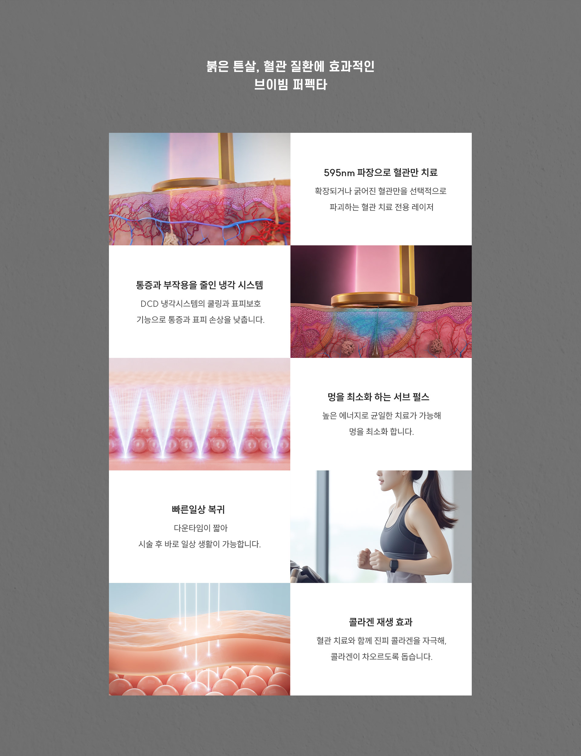 
		8. 붉은 튼살에 브이빔 퍼펙타가 효과적인 이유는 무엇인가요?
		1. 595nm 파장으로 혈관만 치료: 확장되거나 굵어진 혈관만을 선택적으로 파괴하는 혈관 치료 전용 레이저
		2. 통증과 부작용을 줄인 냉각 시스템: DCD 냉각시스템의 쿨링과 표피보호 기능으로 통증과 표피 손상을 낮춥니다.
		3. 멍을 최소화 하는 서브 펄스: 높은 에너지로 균일한 치료가 가능해 멍을 최소화 합니다.
		4. 빠른 일상 복귀: 다운타임이 짧아 시술 후 바로 일상 생활이 가능합니다.
		5. 콜라겐 재생 효과: 혈관 치료와 함께 진피 콜라겐을 자극해, 콜라겐이 차오르도록 돕습니다.
		