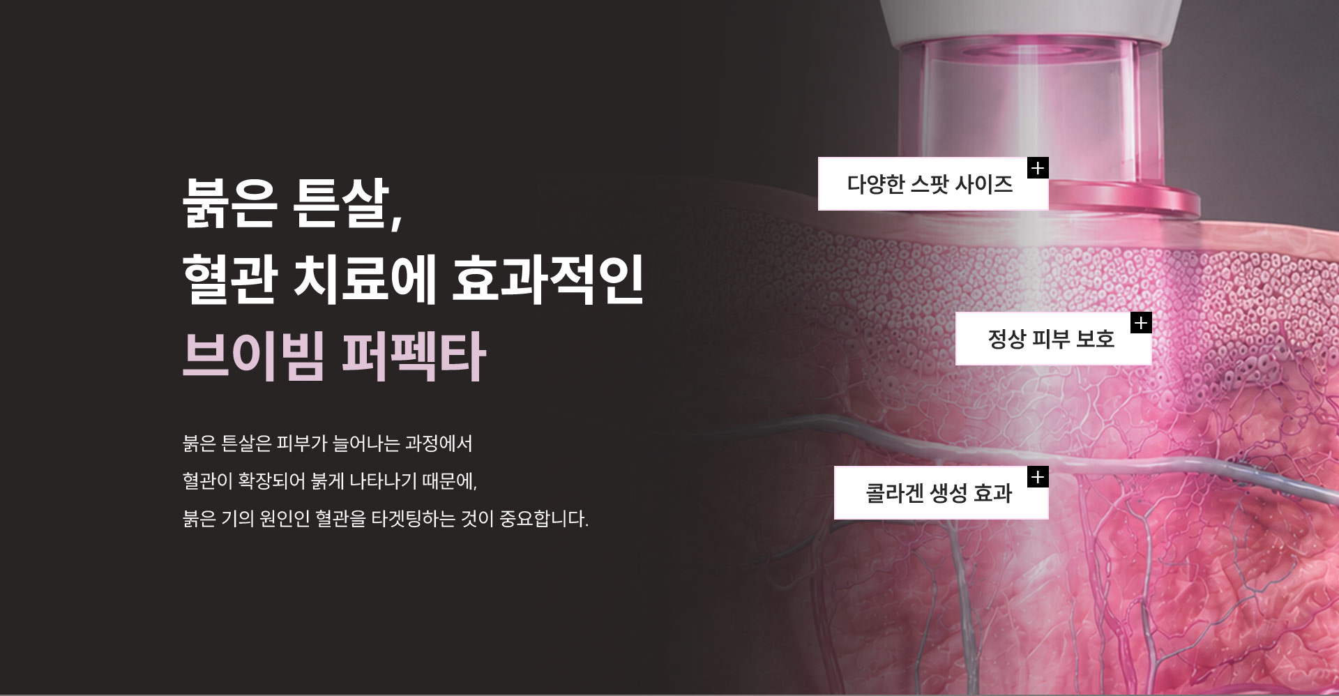 
			6.	붉은 튼살, 혈관 치료에 효과적인 브이빔 퍼펙타란?
			붉은 튼살은 피부가 늘어나는 과정에서 혈관이 확장되어 붉게 나타나기 때문에, 붉은 기의 원인인 혈관을 타겟팅하는 것이 중요합니다.
			1) 다양한 스팟 사이즈
			2) 정상 피부 보호
			3) 콜라겐 생성 효과
		
