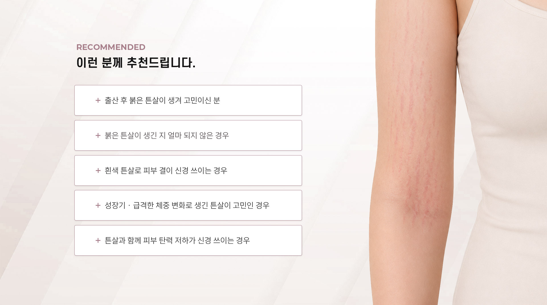 
	어떤 분께 추천드리나요?
	- 피부가 민감하여 통증 없는 안전한 치료를 찾는 경우
	- 붉은 튼살이 생긴 지 얼마 되지 않은 경우
	- 흰색 튼살로 피부 결이 신경 쓰이는 경우
	- 임신·성장기·체중 변화로 생긴 튼살이 고민인 경우
	- 튼살과 함께 피부 탄력 저하가 신경 쓰이는 경우
	