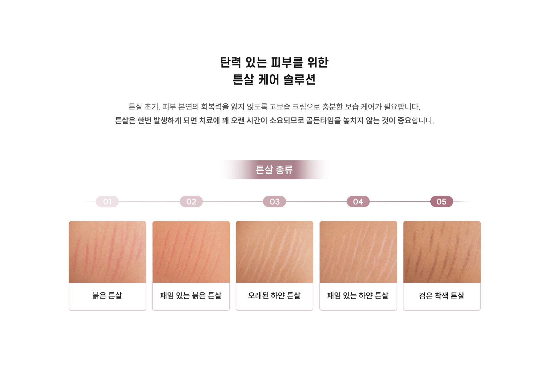 
	10. 탄력 있는 피부를 위한 튼살 케어 솔루션은 무엇인가요?
	튼살 초기, 피부 본연의 회복력을 잃지 않도록 고보습 크림으로 충분한 보습 케어가 필요합니다. 튼살은 한번 발생하게 되면 치료에 꽤 오랜 시간이 소요되므로 골든타임을 놓치지 않는 것이 중요합니다.
	1. 붉은 튼살
	2. 패임있는 튼살
	3. 오래된 하얀 튼살
	4. 패임 있는 하얀 튼살
	5. 검은 착색 튼살
	