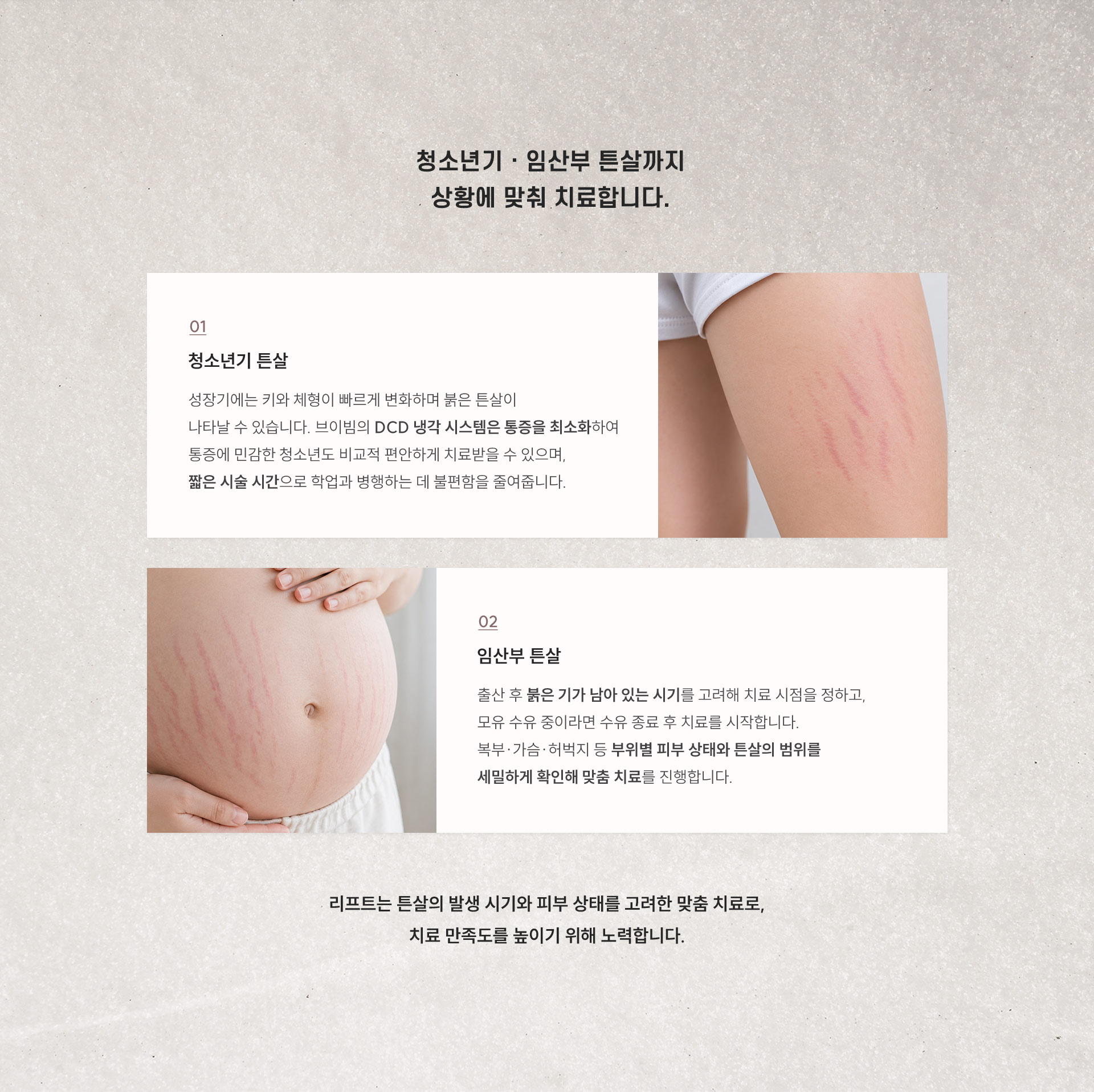 
	10.	청소년기 · 임산부 튼살은 어떻게 치료하나요?
	1) 청소년기 튼살 - 성장기에는 키와 체형이 빠르게 변화하며 붉은 튼살이 나타날 수 있습니다. 브이빔의 DCD 냉각 시스템은 통증을 최소화하여 통증에 민감한 청소년도 비교적 편안하게 치료받을 수 있으며, 짧은 시술 시간으로 학업과 병행하는 데 불편함을 줄여줍니다.

	2) 임산부 튼살
	- 출산 후 붉은 기가 남아 있는 시기를 고려해 치료 시점을 정하고, 모유 수유 중이라면 수유 종료 후 치료를 시작합니다. 복부·가슴·허벅지 등 부위별 피부 상태와 튼살의 범위를 세밀하게 확인해 맞춤 치료를 진행합니다.
	