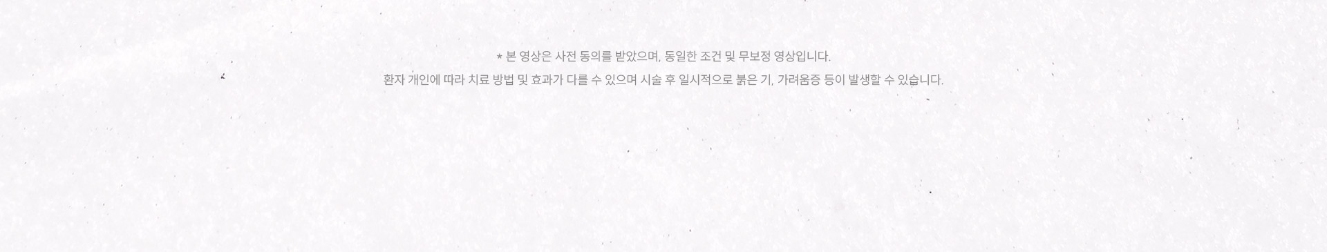 
	* 본 영상은 사전 동의를 받았으며, 무보정 영상입니다.
	환자 개인에 따라 치료 방법 및 효과가 다를 수 있으며 시술 후 일시적으로 붉은 기, 가려움증 등이 발생할 수 있습니다.
	
