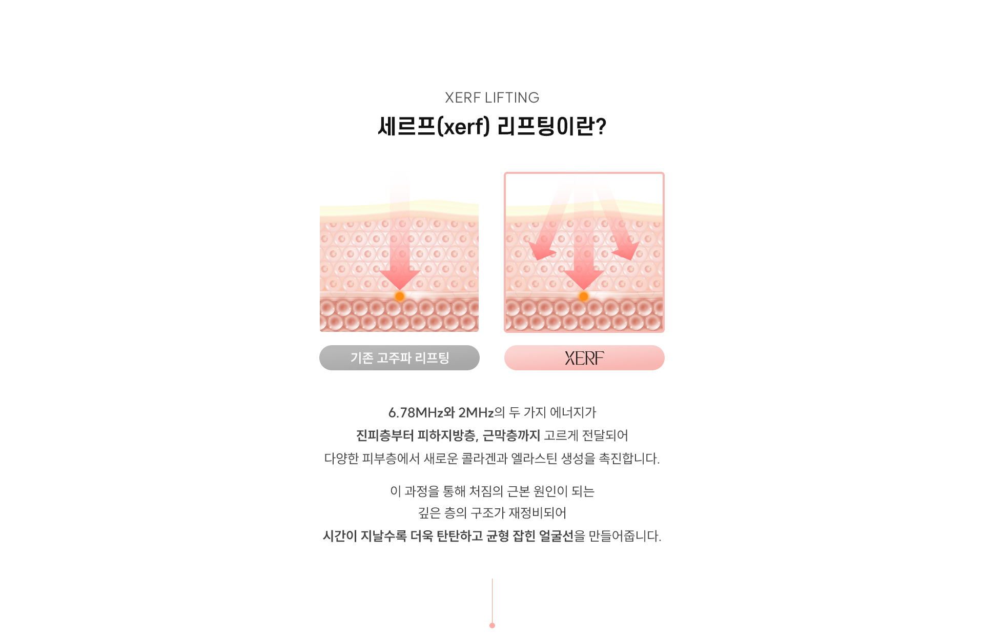 
	3.세르프란?(What is XERF?)
	6.78MHz와 2MHz의 두 가지 에너지가 진피층부터 피하지방층, 근막층까지 고르게 전달되어 다양한 피부층에서 새로운 콜라겐과 엘라스틴 생성을 촉진합니다.
	이 과정을 통해 처짐의 근본 원인이 되는 깊은 층의 구조가 재정비되어 시간이 지날수록 더욱 탄탄하고 균형 잡힌 얼굴선을 만들어줍니다.
	