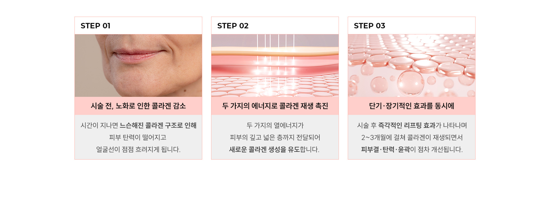 
	STEP1:시술 전, 노화로 인한 콜라겐 감소 시간이 지나면 느슨해진 콜라겐 구조로 인해 피부 탄력이 저하되고, 얼굴선이 흐려지게 됩니다.
	STEP2:두 가지 종류의 에너지로 콜라겐 재생 촉진 두 가지 종류의 에너지가 피부 깊고 넓은 층까지 전달되어 기존 콜라겐을 수축시키고 새로운 콜라겐 생성을 유도
	STEP3:단기적인 효과와 장기적인 효과를 동시에 직후에는 열에너지로 인한 즉각적인 리프팅 효과가 나타나며, 이후 2~3개월에 걸쳐 콜라겐 재생이 활발히 일어나면서 피부결·탄력·윤곽이 점진적으로 개선됩니다.
	