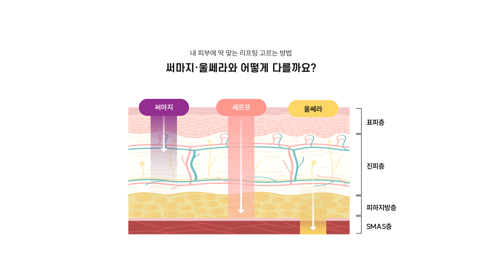 
	5.써마지FLX, 세르프, 울쎄라는 어떤 점이 다른가요?
	