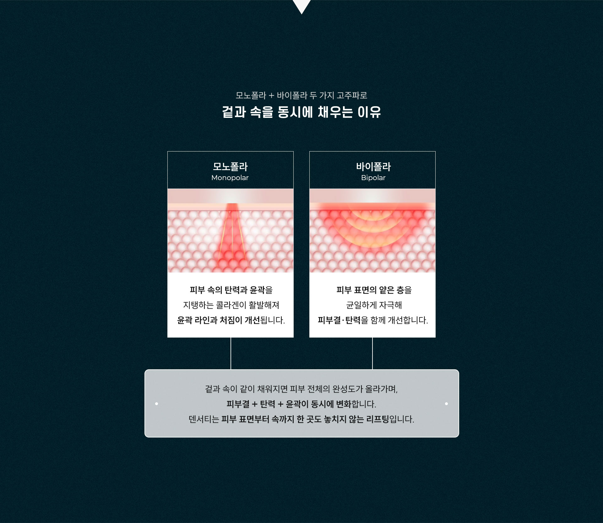 
	겉과 속을 동시에 채우는 이유는?
	1)바이폴라: 피부 표면의 얕은 층을 균일하게 자극해 피부결과 탄력을 개선합니다.
	2)모노폴라: 피부 속의 탄력과 얼굴선을 지탱하는 콜라겐이 활발해져 얼굴선과 처짐이 개선됩니다.
	겉과 속이 같이 채워지면 피부 전체의 완성도가 올라가며, 피부결 + 탄력 + 윤곽이 동시에 변화합니다.
	덴서티는 피부 표면부터 속까지 한 곳도 놓치지 않는 리프팅입니다.
	