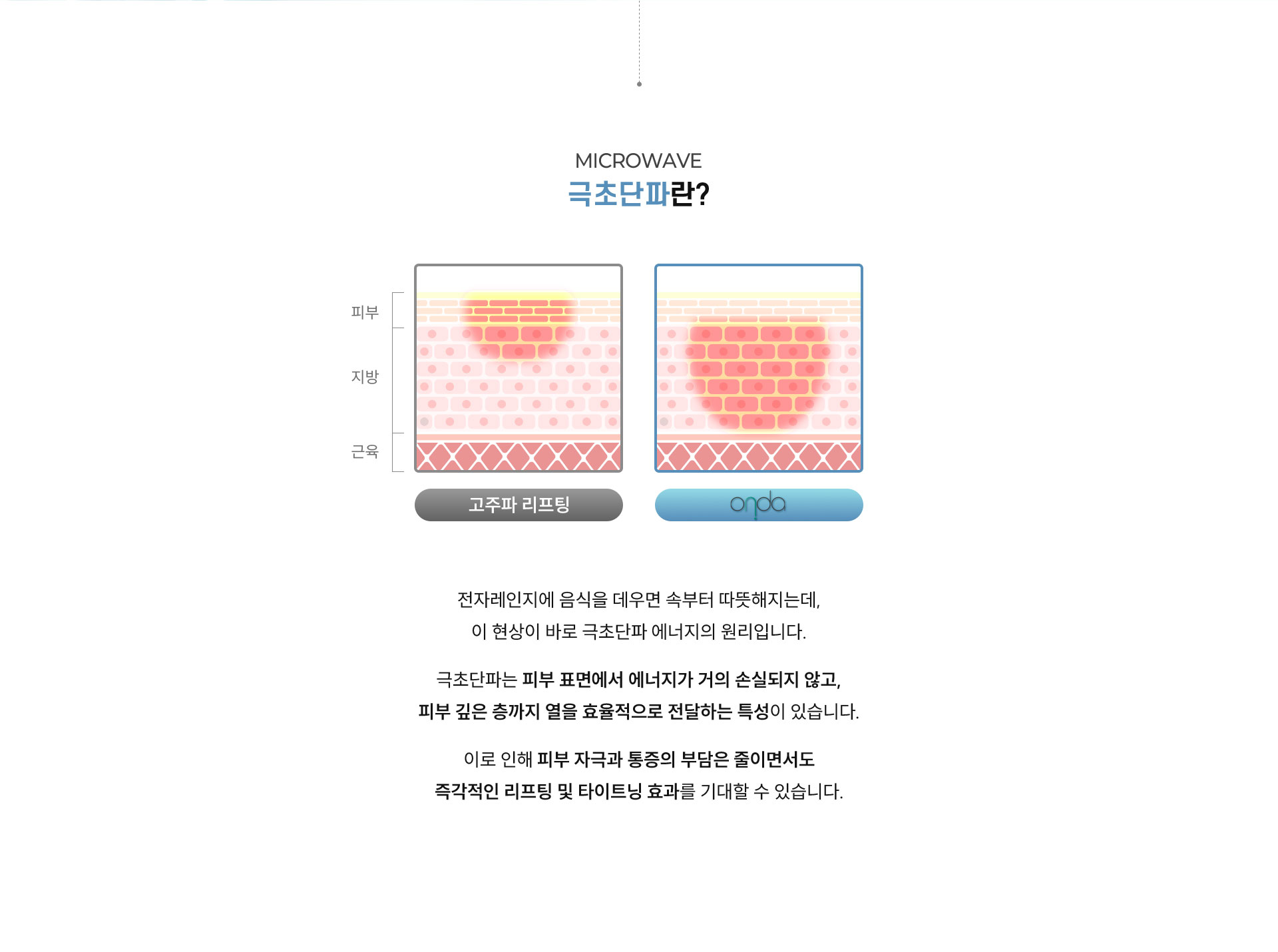 
	온다 리프팅의 피부를 표면은 보호하고, 깊은 층만 정확하게 타깃하는 Contact Cooling 듀얼 시스템은 무엇인가요?
	고주파 리프팅은 피부 표면에 가장 많은 에너지가 전달되고 아래로 갈수록 전달되는 에너지의 양이 줄어듭니다.
	온다는 피부 표면은 파란색으로 차갑게 유지되고, 80% 이상의 에너지를 피부 깊숙한 곳과 지방에만 전달합니다.
	깊은 진피층에 전달된 에너지는 콜라겐 재생을 유도해 탄력을 개선하고 지방층에 전달된 에너지는 지방세포 감소를 유도하여 윤곽라인을 개선해 줍니다. 
	
