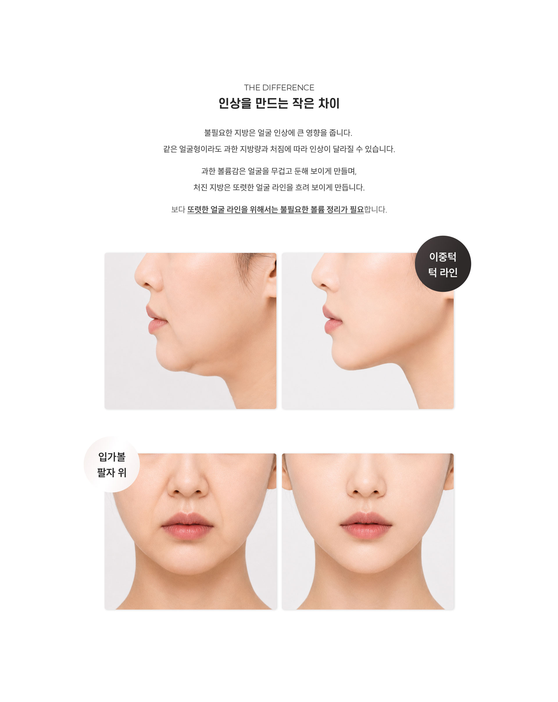 
	2.	대구윤곽주사, 인상을 만드는 작은 차이는?

		불필요한 지방은 얼굴 인상에 큰 영향을 줍니다. 
		같은 얼굴형이라도 과한 지방량과 처짐에 따라 인상이 달라질 수 있습니다.
		과한 볼륨감은 얼굴을 무겁고 둔해 보이게 만들며,
		처진 지방은 또렷한 얼굴 라인을 흐려 보이게 만듭니다.
		보다 또렷한 얼굴 라인을 위해서는 불필요한 볼륨 정리가 필요합니다.
	