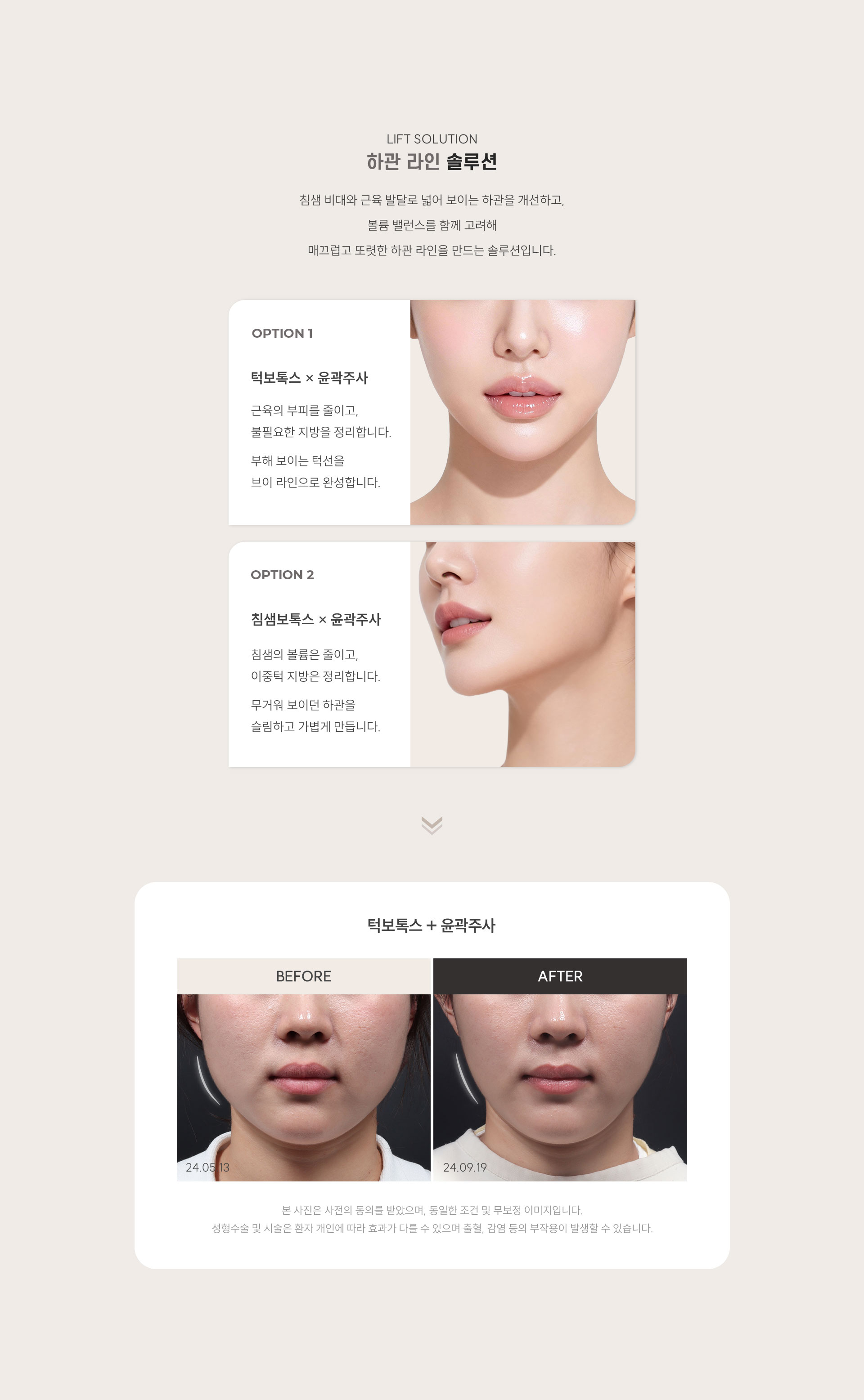 
	6.	윤곽주사, 하관 라인 개선 조합은?

		침샘 비대와 근육 발달로 넓어 보이는 하관을 개선하고,
		볼륨 밸런스를 함께 고려해
		매끄럽고 또렷한 하관 라인을 만드는 솔루션입니다

		1) 턱보톡스+윤곽주사
			근육의 부피를 줄이고, 불필요한 지방을 정리합니다.
			부해 보이는 턱선을 브이 라인으로 완성합니다.

		2) 침샘보톡스+윤곽주사
			침샘의 볼륨은 줄이고, 이중턱 지방은 정리합니다.
			무거워 보이던 하관을 슬림하고 가볍게 만듭니다.
	