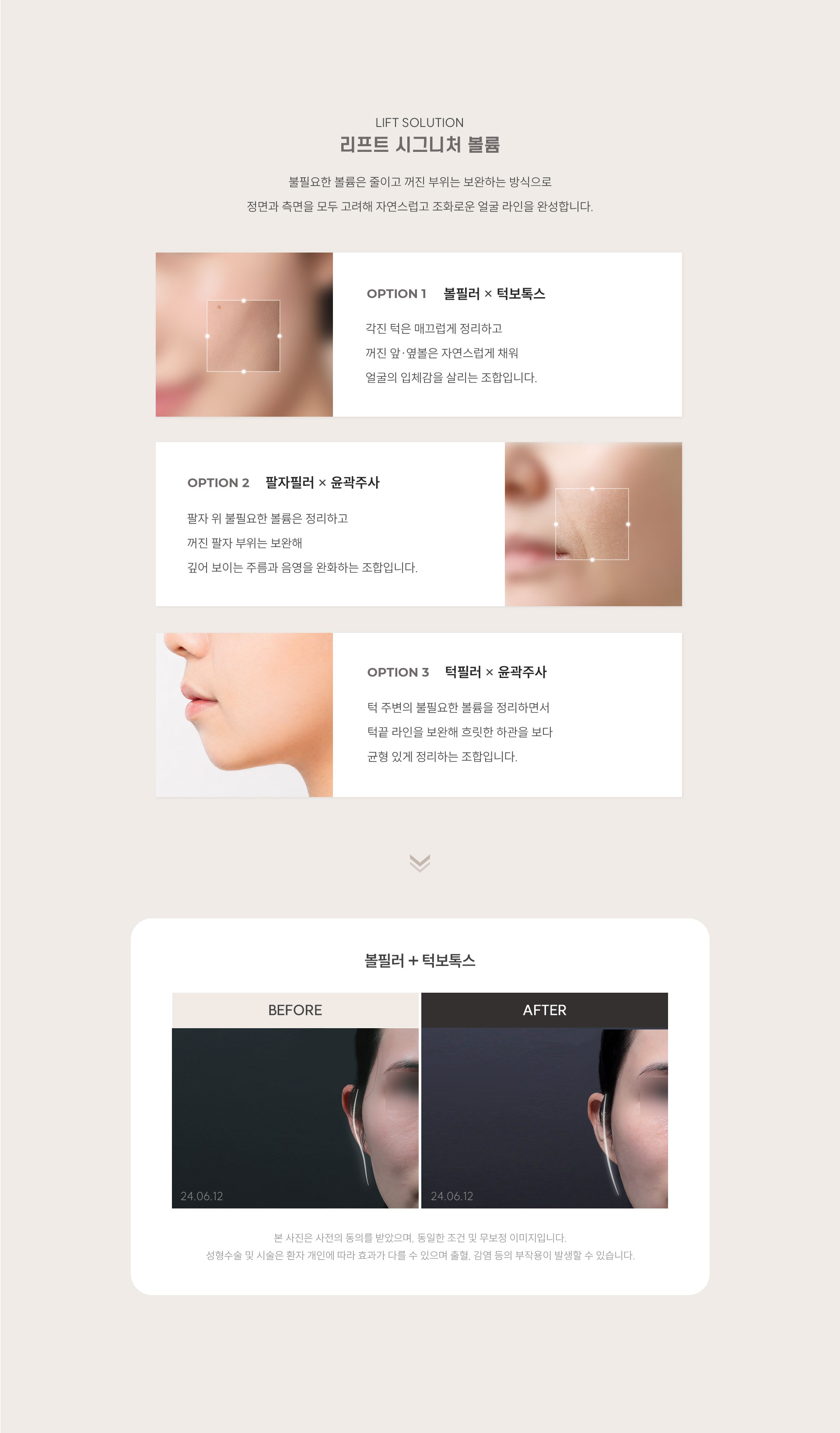 
	8.	리프트 시그니처 볼륨의 조합은?

		불필요한 볼륨은 줄이고 꺼진 부위는 보완하는 방식으로
		정면과 측면을 모두 고려해 자연스럽고 조화로운 얼굴 라인을 완성합니다.

		1) 볼필러 + 턱보톡스
			각진 턱은 매끄럽게 정리하고
			꺼진 앞·옆볼은 자연스럽게 채워
			얼굴의 입체감을 살리는 조합입니다.
		 
		2) 팔자필러 + 윤곽주사
			팔자 위 불필요한 볼륨은 정리하고 꺼진 팔자 부위는 보완해
			깊어 보이는 주름과 음영을 완화하는 조합입니다.

		3) 턱필러 + 윤곽주사
			턱 주변의 불필요한 볼륨을 정리하면서
			턱끝 라인을 보완해 흐릿한 하관을 보다 균형 있게 정리하는 조합입니다.
	