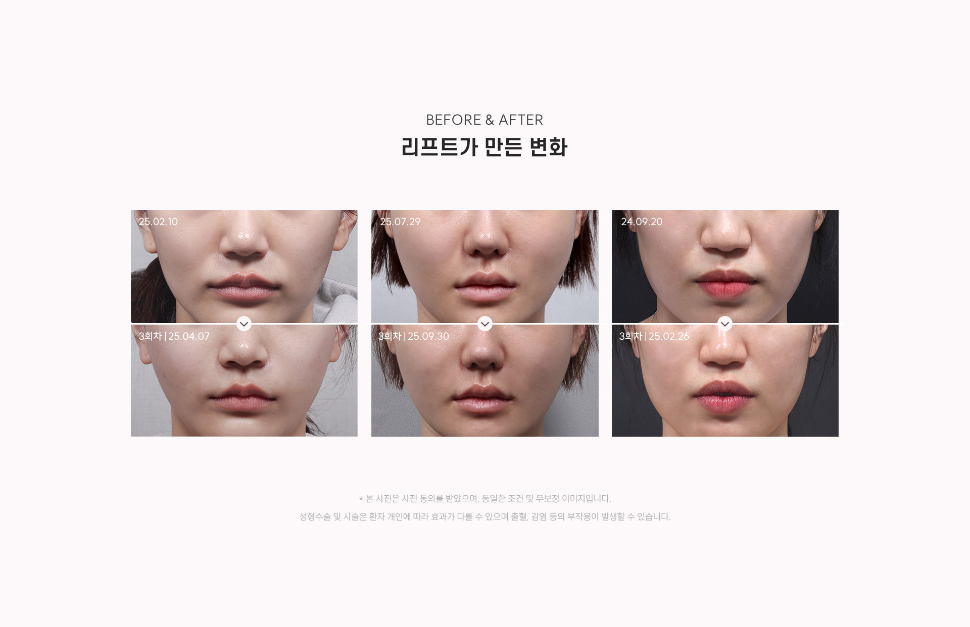 
		9. 리프트가 만든 변화는? 쥬배룩 볼륨 3회차 후기 
		