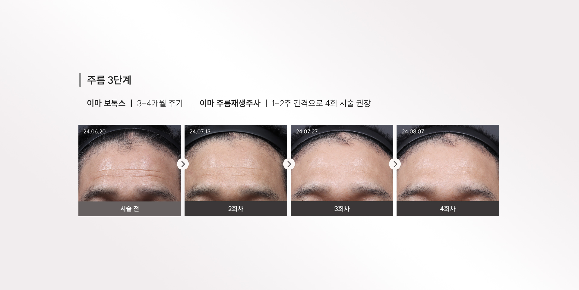 
	3) 주름 3단계
	이마 보톡스: 3-4개월 주기
	이마 주름재생주사: 1-2주 간격으로 4회 시술 권장
	