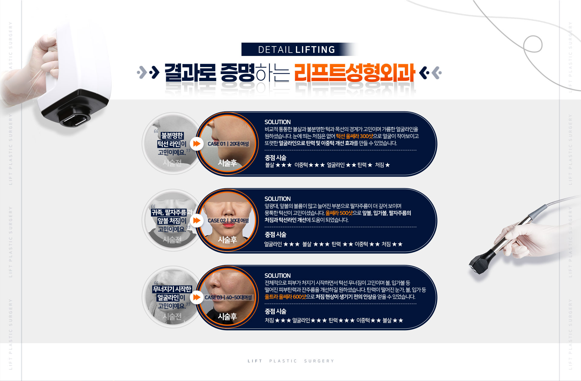 홈페이지 전후사진 링크